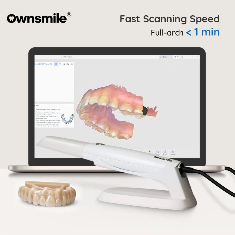Ownsmile OS-5S Intraoral Scanner – High-Precision ≤5μm, Fast Full-Arch Scanning