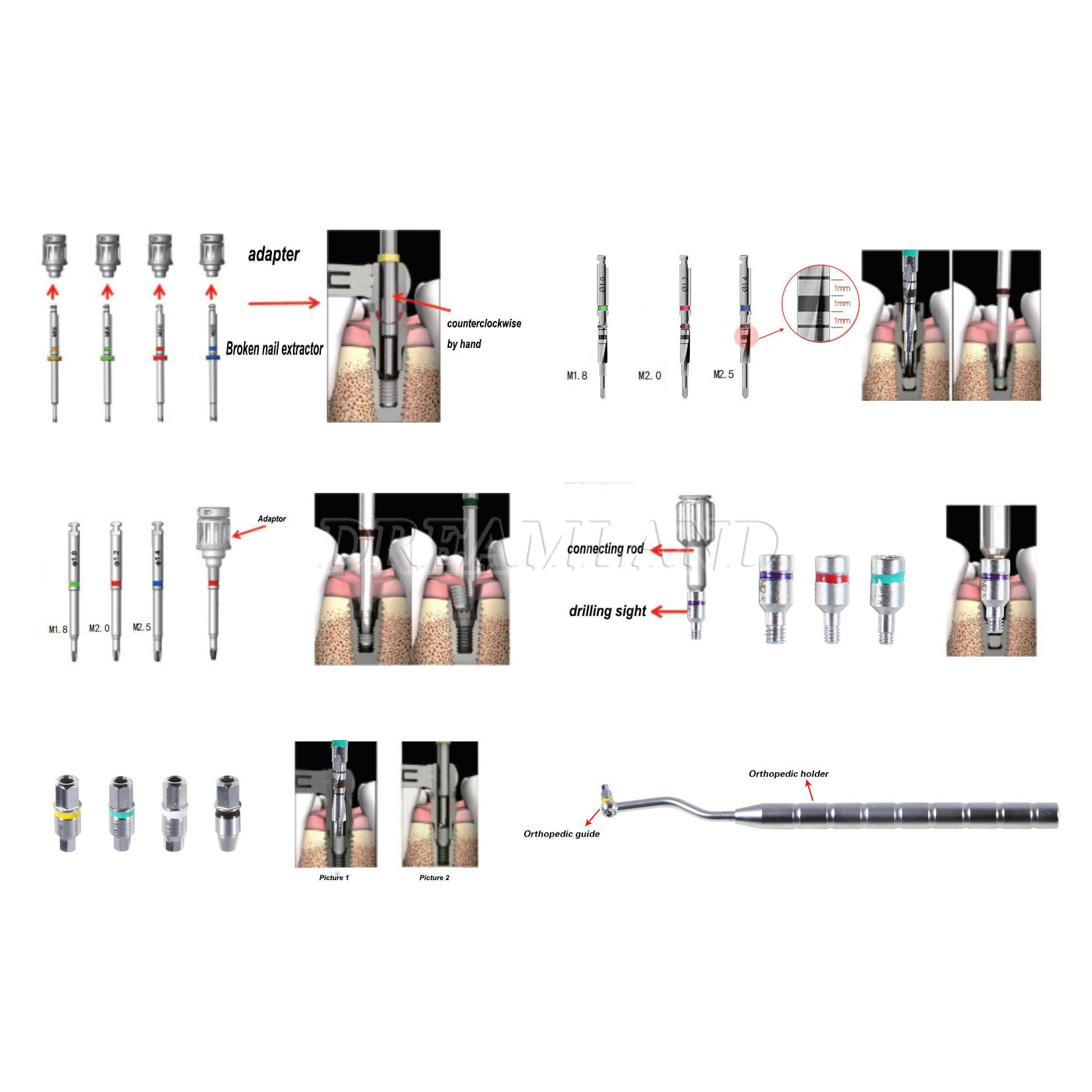 Dental Implant Screw Removal Kit Remove Drill Fractured Claw Revese Guide SRK